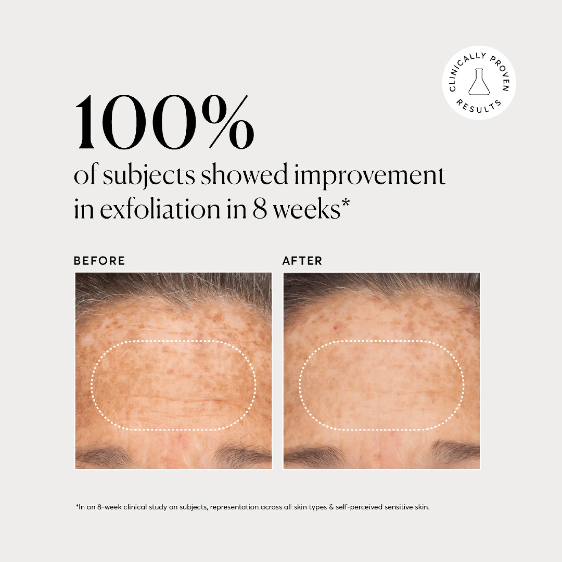 bha-liquid-exfoliant-2-q4 NATR-10027-Alt-Images-BHA-Liquid-Exfoliant-2_-03.webp